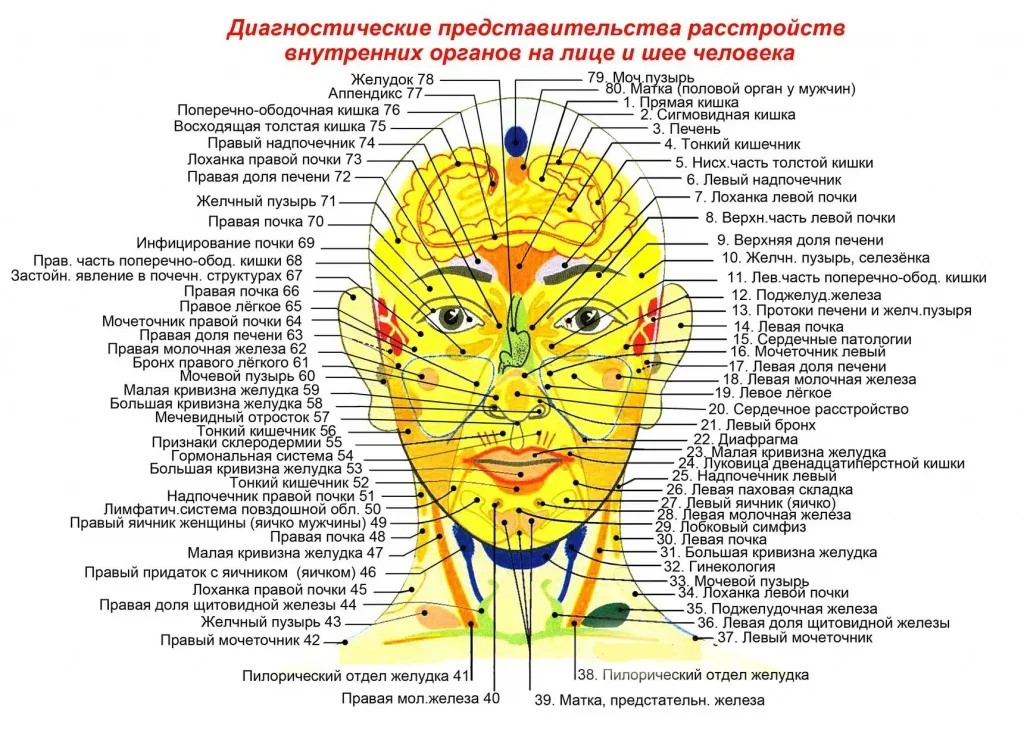 Акне: что такое акне на лице, причины, симптомы. Лечение акне на лице в клинике ROSH